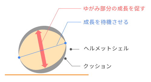 ヘルメット治療の原理